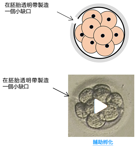 經鐳射光處理後