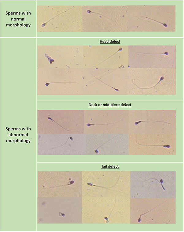 How does a sperm look like?