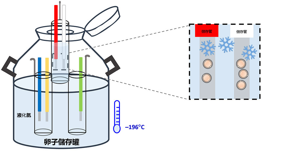 Egg Storage Tank