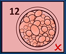 EmbryoScope