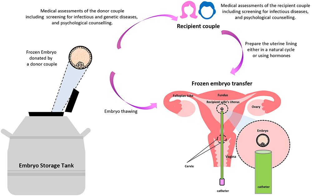 Embryo Donation Flowchart