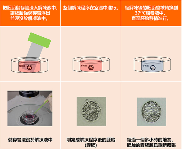 病人有某些疾病需要治療，待痊癒後才適合移植胚胎