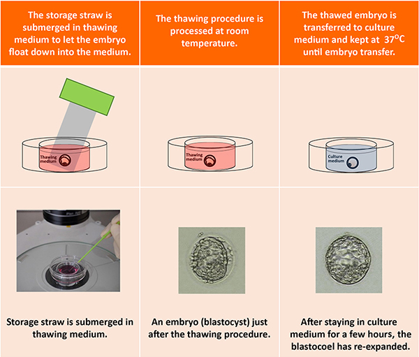 Bring the storage straw out from the embryo storage tank