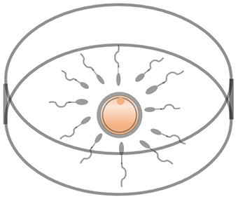 Conventional Insemination