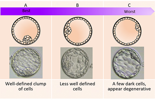 Inner cell mass (ICM)