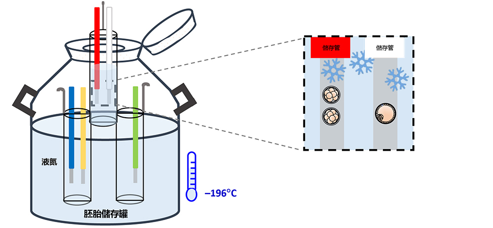 Embryo Freezing