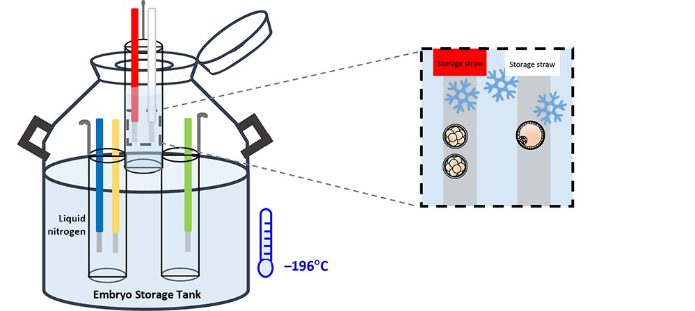 Embryo Freezing