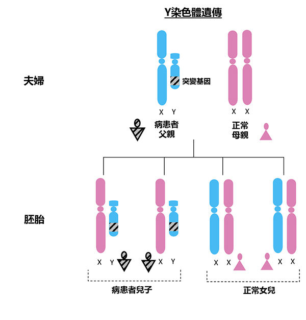 Y染色體遺傳病