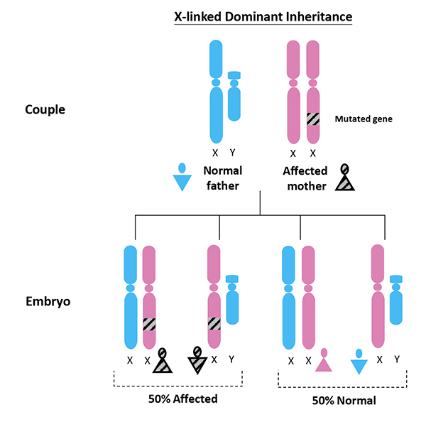 X-linked Dominant Disorder