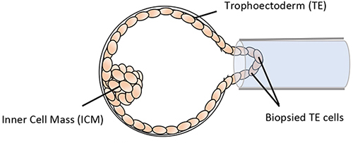 Blastocyst biopsy