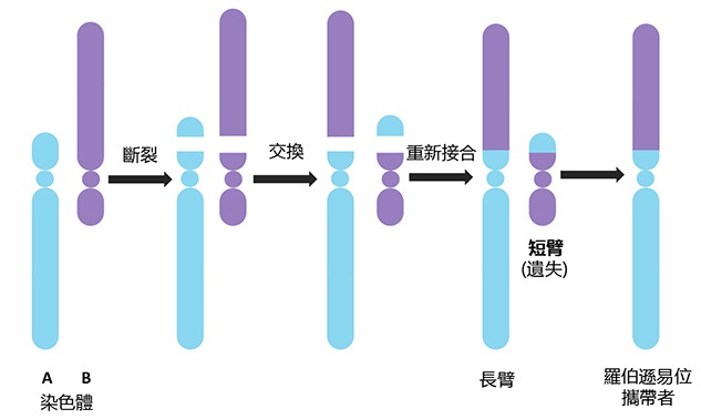 羅伯遜易位