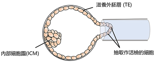 Blastocyst biopsy