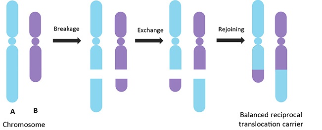 Balanced Reciprocal Translocation