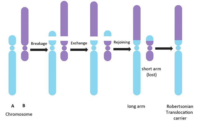 Robertsonian Translocation