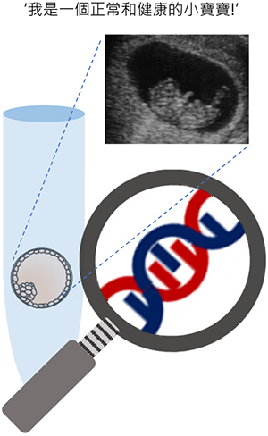 Pre-implantation Genetic Testing (PGT)