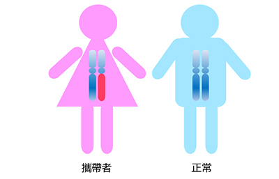 Pre-implantation Genetic Testing for Monogenic / Single Gene Disorders (PGT-M) 