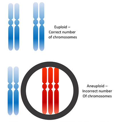 Pre-implantation Genetic Testing for Aneuploidies (PGT-A)