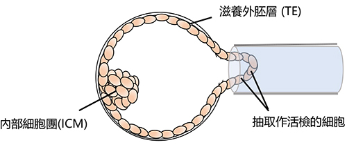 Blastocyst biopsy