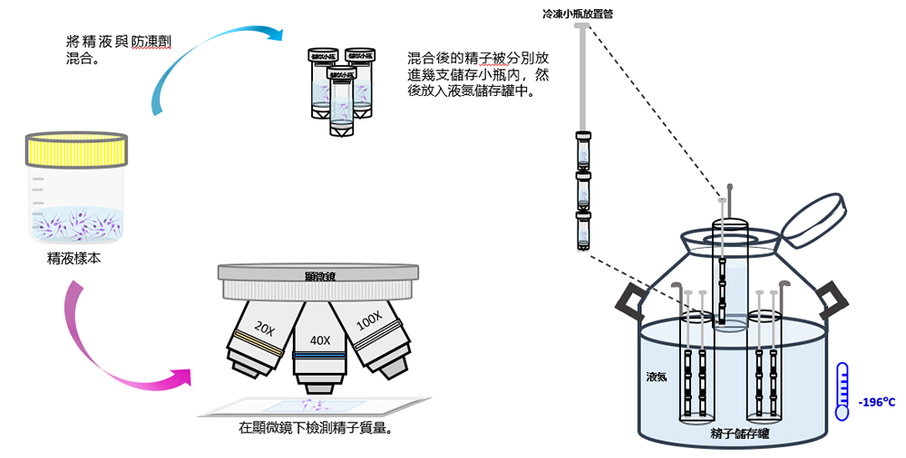 Sperm freezing 