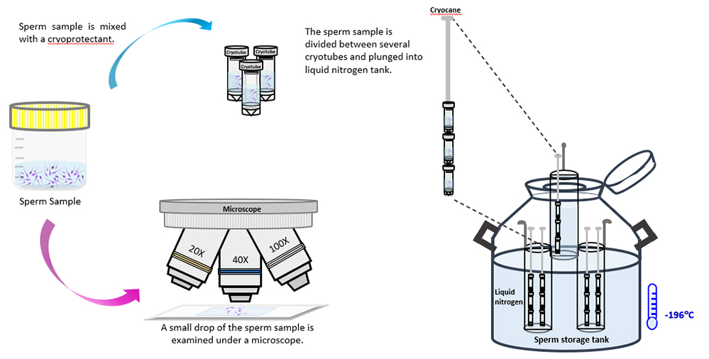 Sperm Sample